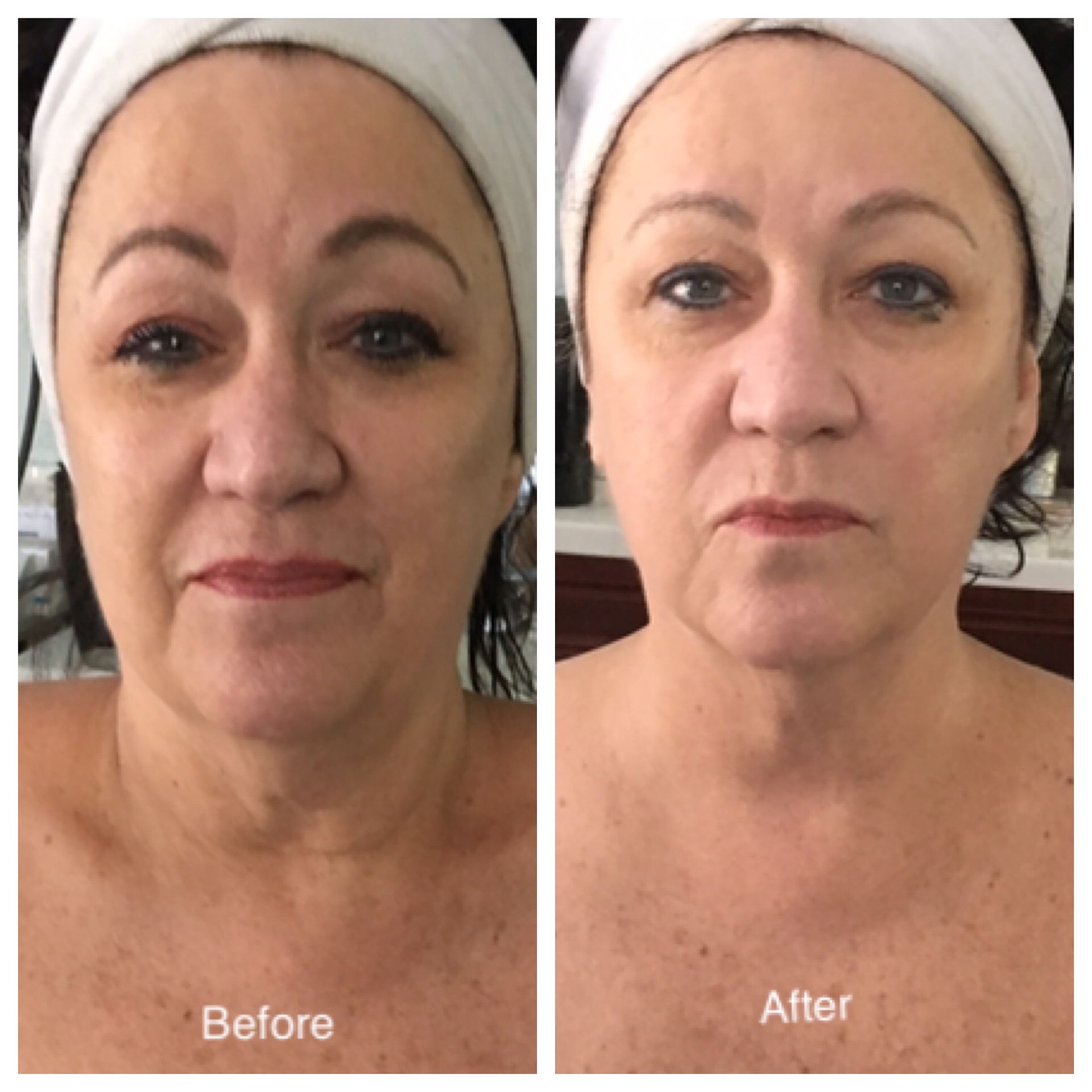 A before and after photo of a woman 's face with a towel on her head.