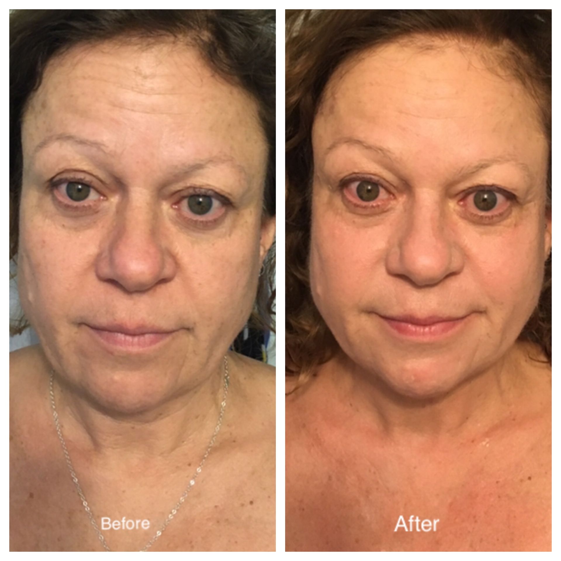 A before and after photo of a woman 's face.