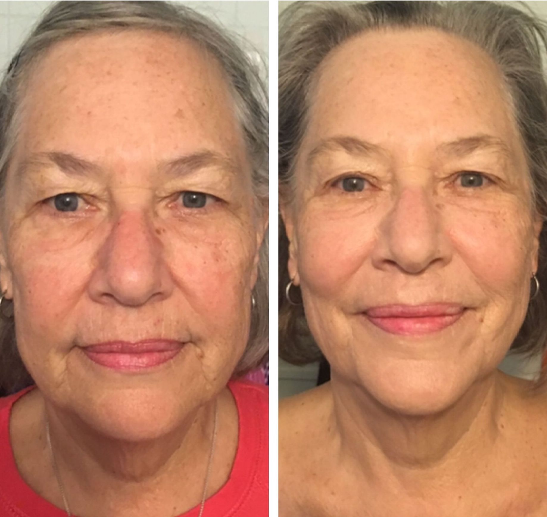 A before and after photo of a woman 's face.