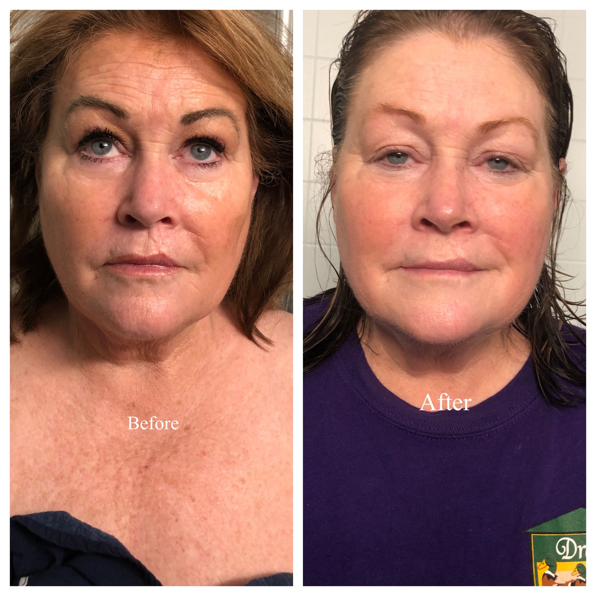 A before and after photo of a woman 's face.