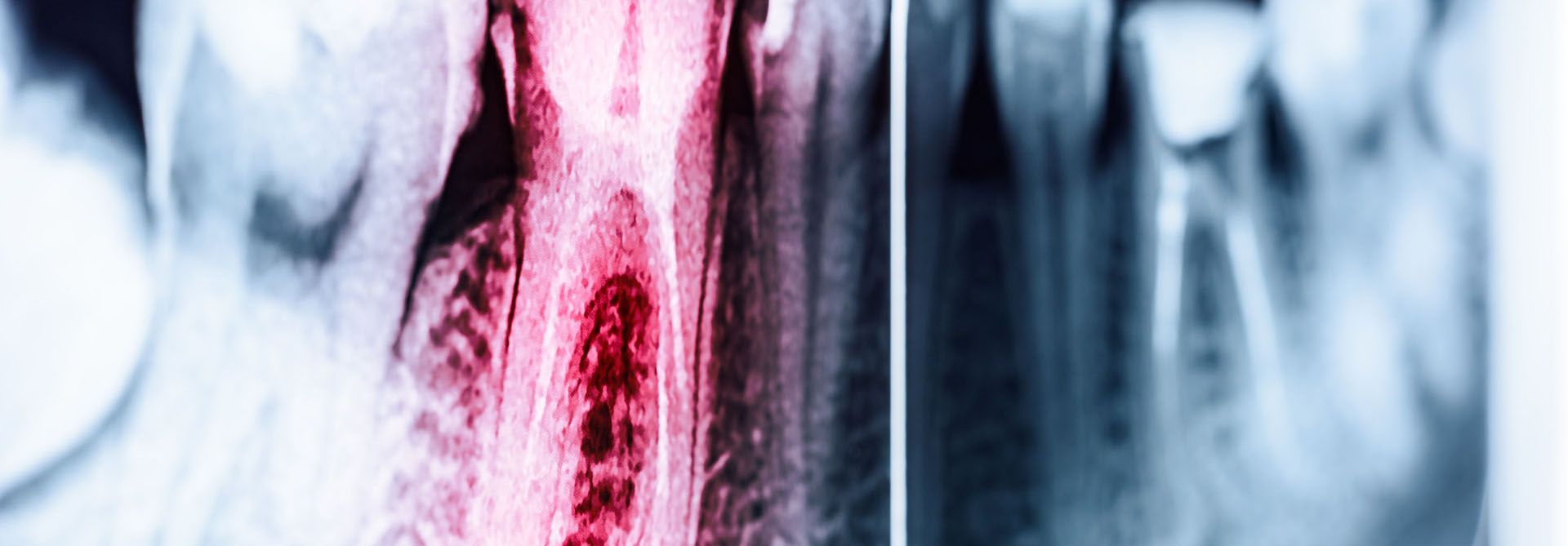 CONSERVATIVA ED ENDODONZIA