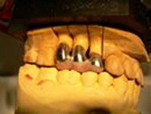 implantologia Perugia