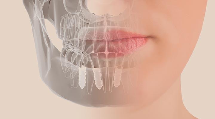 CENTRO DE IMPLANTOLOGÍA DENTAL OSEOINTEGRADA Y ORTODONCIA - ORTODONCIA
