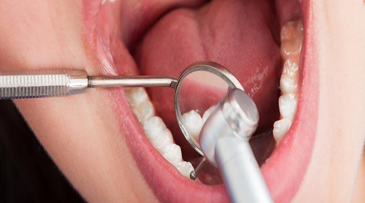 CENTRO DE IMPLANTOLOGÍA DENTAL OSEOINTEGRADA Y ORTODONCIA - ENDODONCIA
