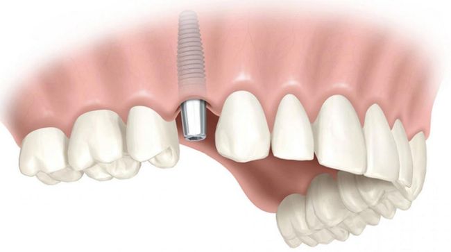 CENTRO DE IMPLANTOLOGIA DENTAL OSEOINTEGRADA Y ORTODONCIA