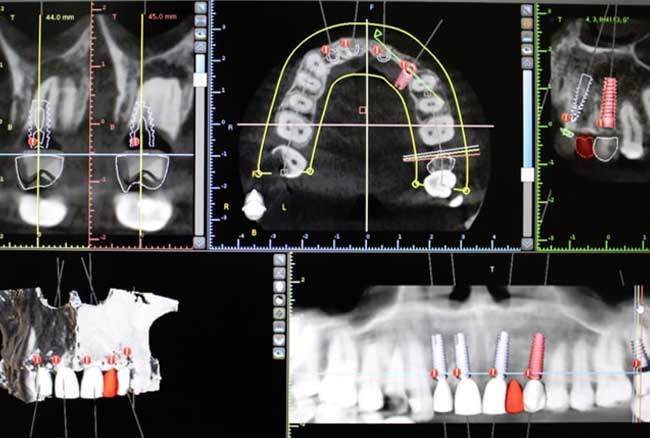CENTRO DE IMPLANTOLOGÍA DENTAL OSEOINTEGRADA Y ORTODONCIA - RADIOGRAFIA
