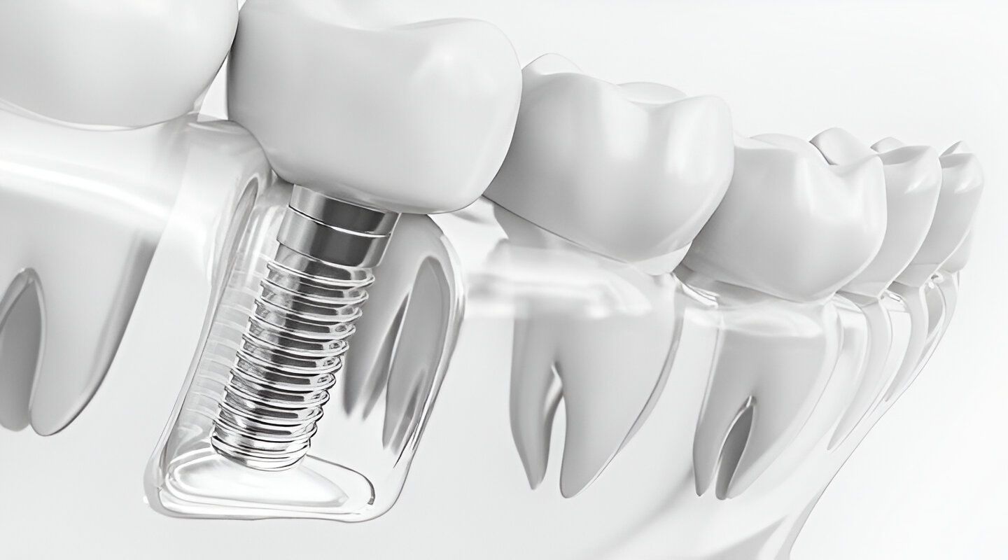 CENTRO DE IMPLANTOLOGÍA DENTAL OSEOINTEGRADA Y ORTODONCIA - CIRUGIA BUCAL
