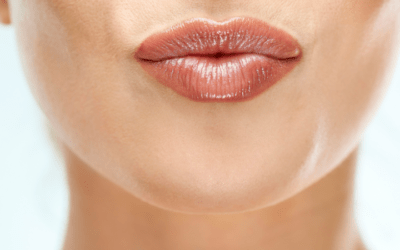 Get the Perfect Pout with the Botox Lip Flip: A Non-Invasive Solution