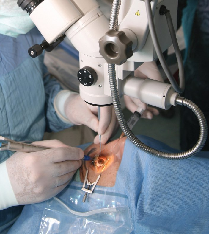 Intervento chirurgico agli occhi in corso: il chirurgo utilizza un microscopio e degli strumenti sull'occhio di un paziente.
