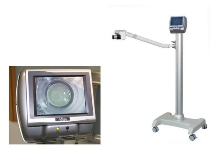 Un dispositivo medico per l'esame della vista. Uno schermo a sinistra mostra un occhio; il dispositivo è su un supporto mobile a destra.