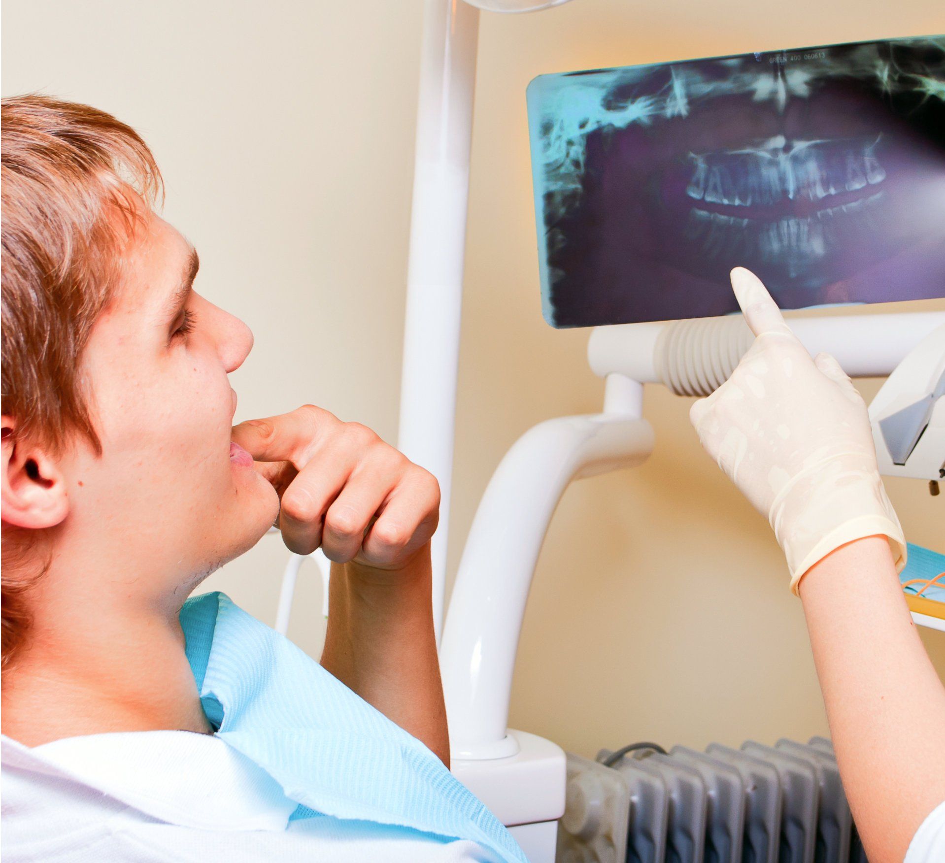 Root canal Treatments - Special Smiles Special Smiles General Dentistry