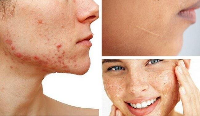 Sanatorio Querétaro S.A. de C.V. 