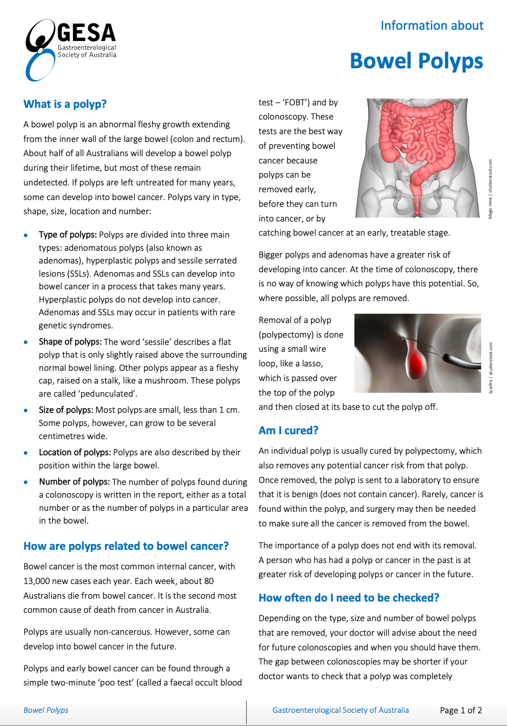 Bowels Polyps Sydney