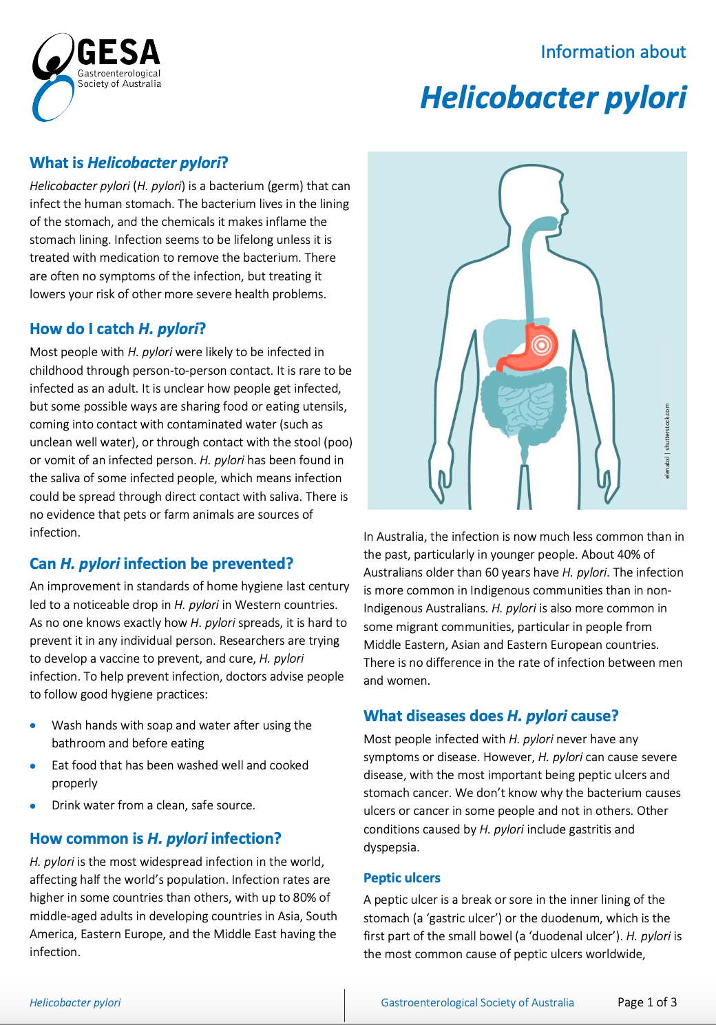 Helicobacter pylori Sydney