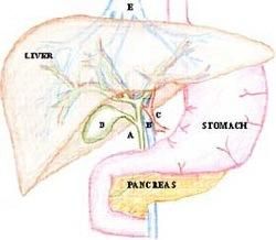 Kidney stone, urinary stone, ureteric stone, renal calculi, renal colic, nephrolithiasis