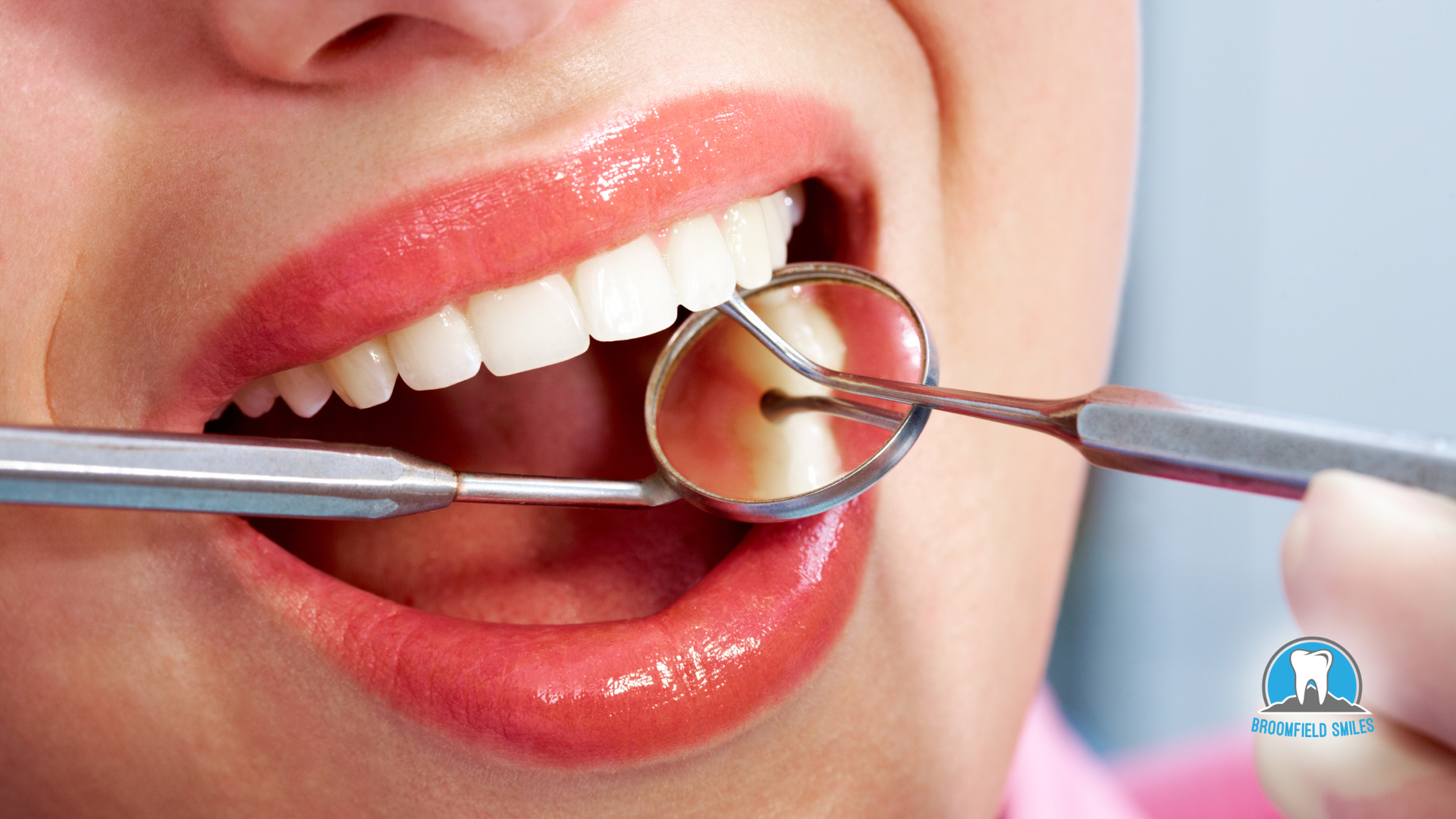 Dentist using a mirror and probe to examine a patient's teeth. Patient's mouth is open, lips are red.