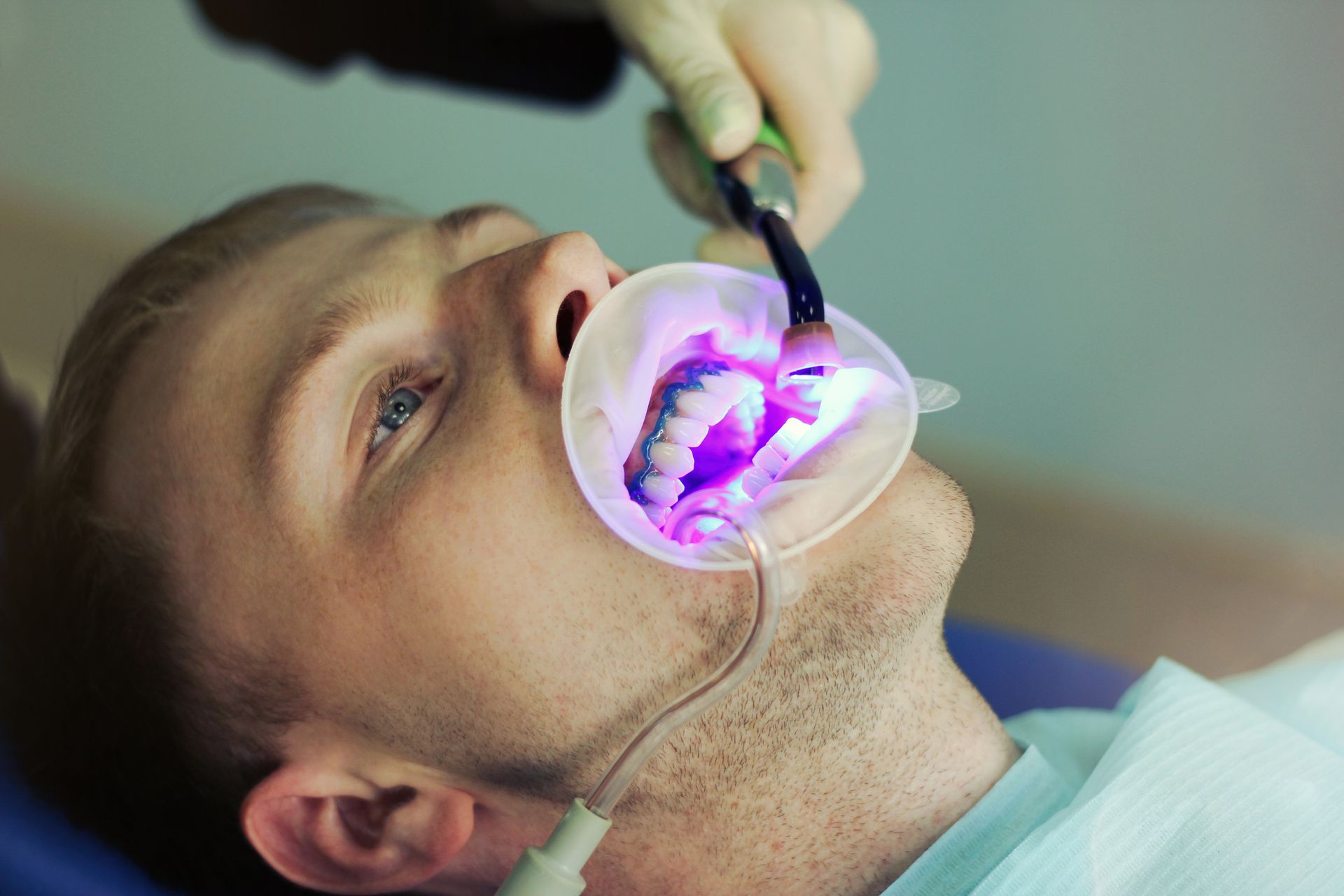 Dentist patient of a Dental Whitening from Andover Family Dentistry in Ramsey, MN