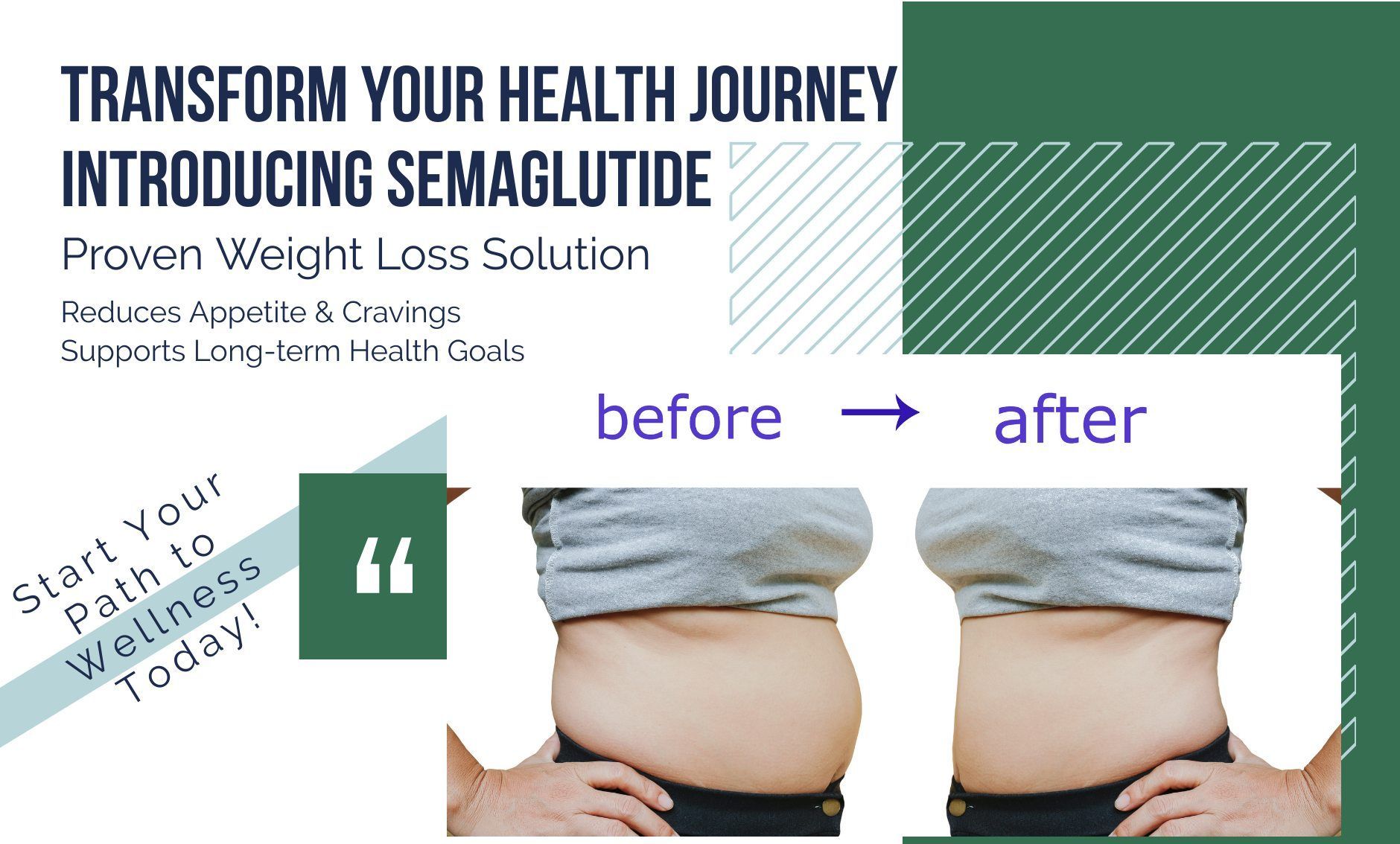 A picture of a woman 's stomach before and after using semaglutide.