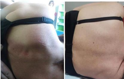 Riabilitazione posturale