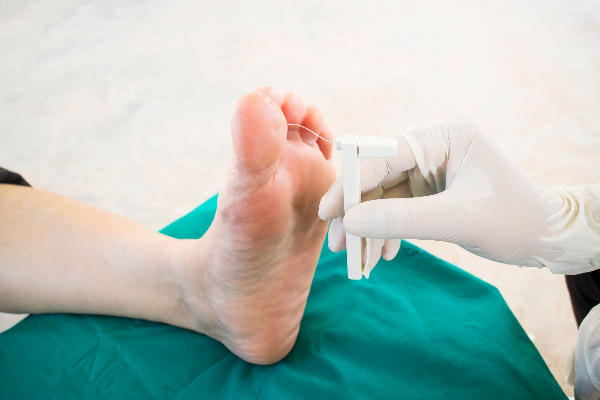 Foot being examined by a gloved hand with a monofilament tool.