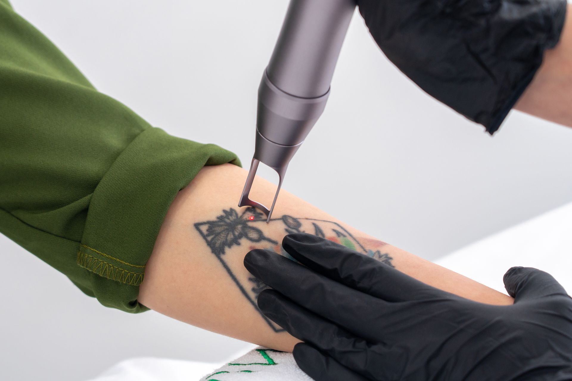 cosmetologist removing tattoo with the laser device