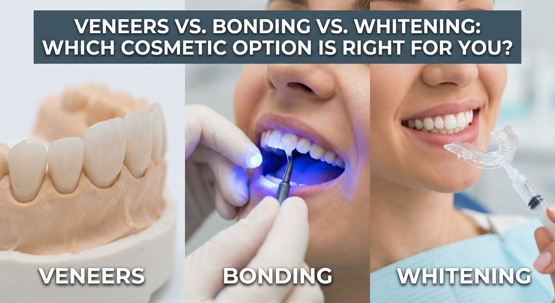 Comparison of cosmetic dental procedures: veneers, bonding, and whitening.