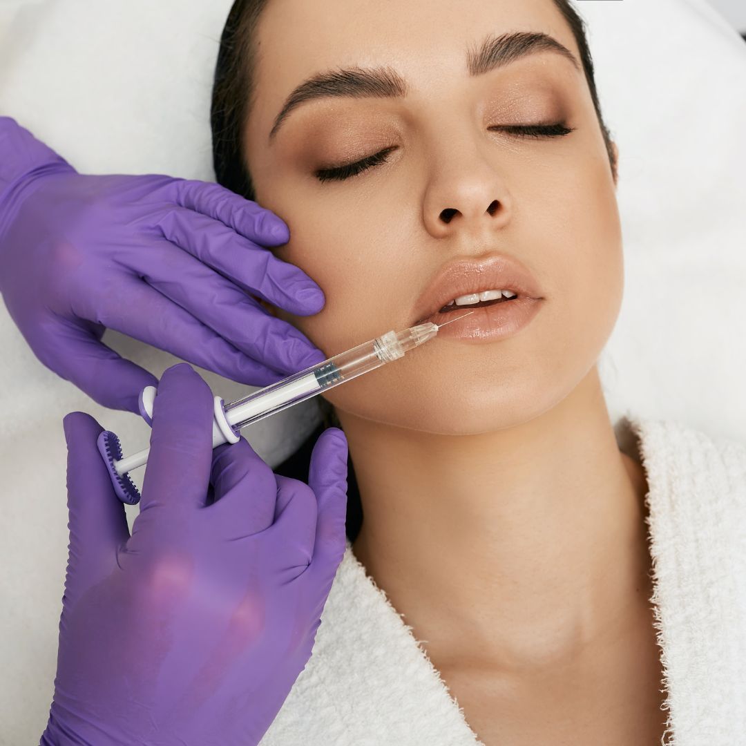 How long until lip fillers settle? Your medical spa questions answered.