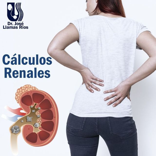 DR JOSÉ LLAMAS RÍOS URÓLOGO DR JOSÉ LLAMAS RÍOS URÓLOGO