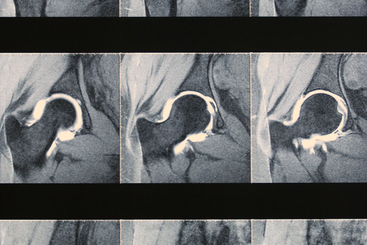 A photo of a patient having a joint scanned