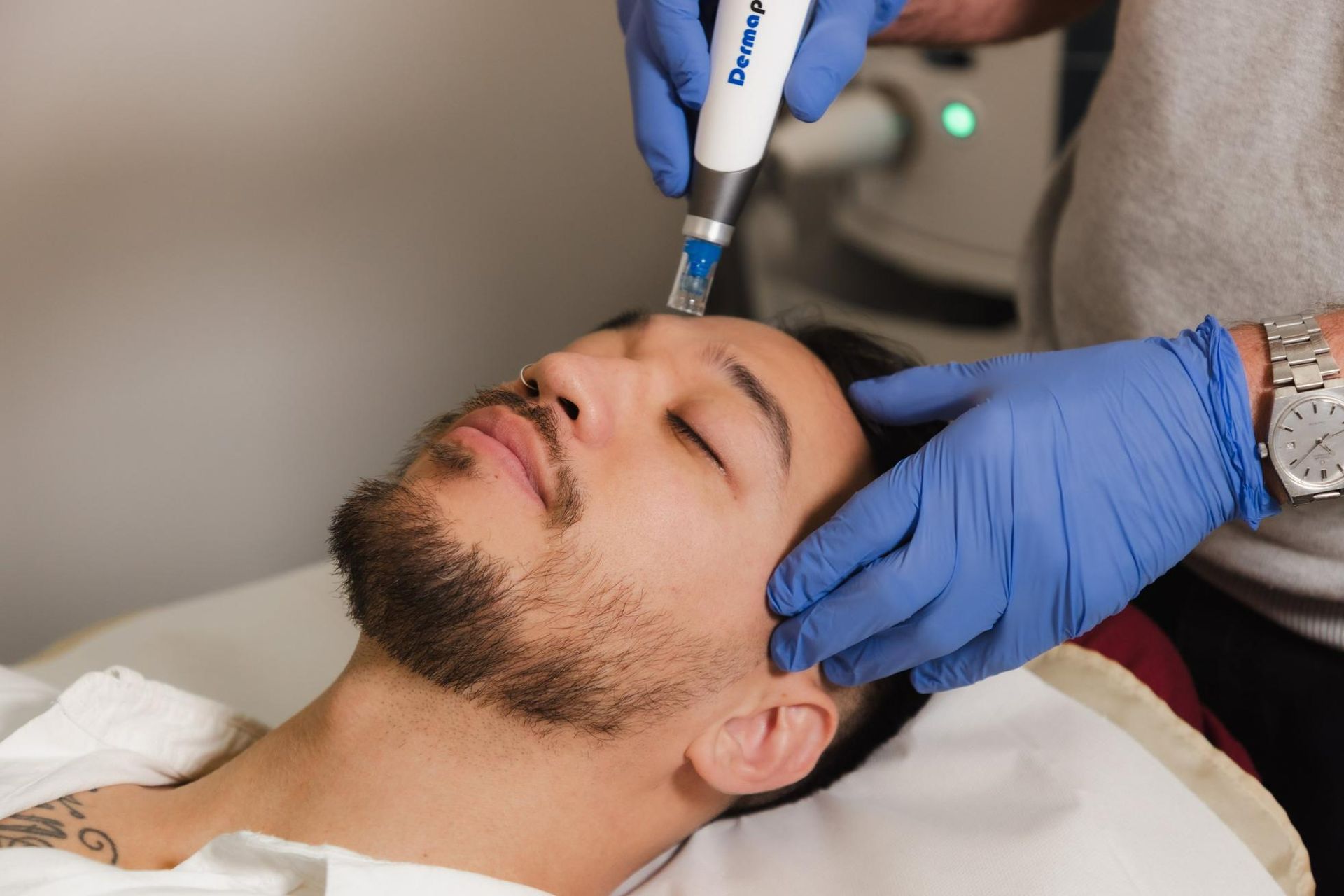 Man With a Beard is Getting a Treatment on His Face — Cimed Aesthetics in Newcastle, NSW