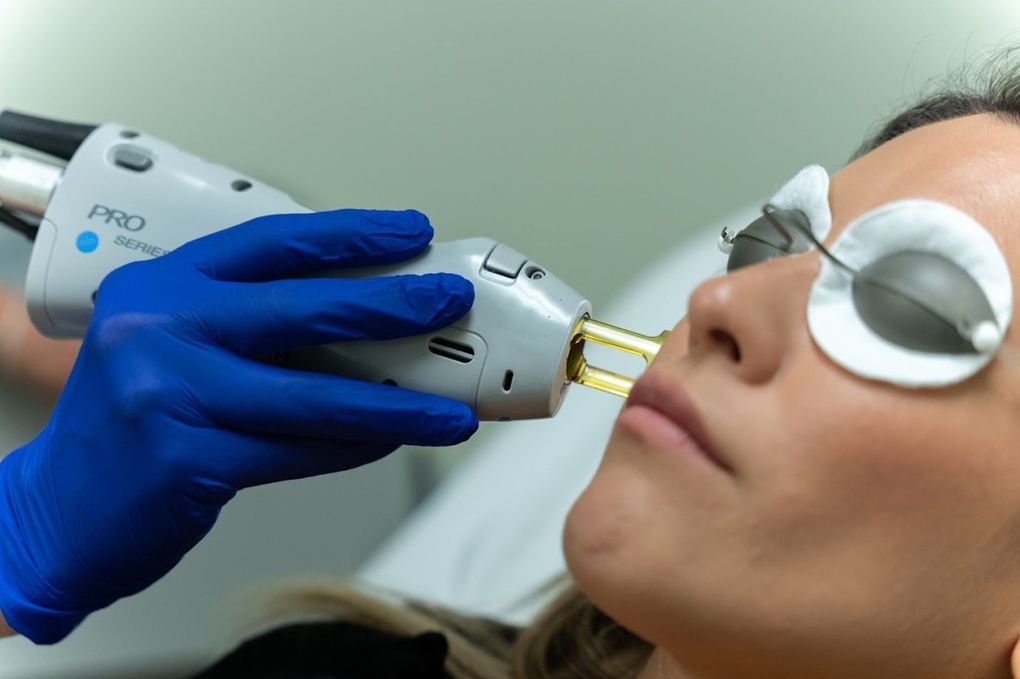 A woman is getting a laser treatment on her face.