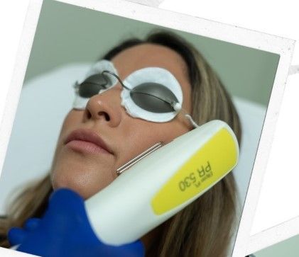 A woman is getting a laser treatment on her face