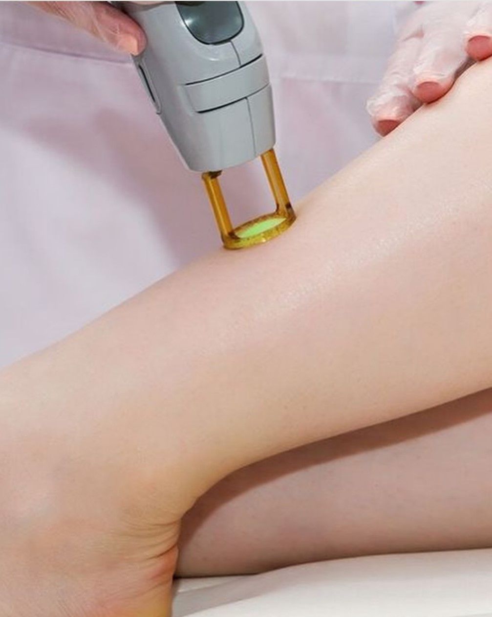 A woman is getting a laser hair removal treatment on her legs.