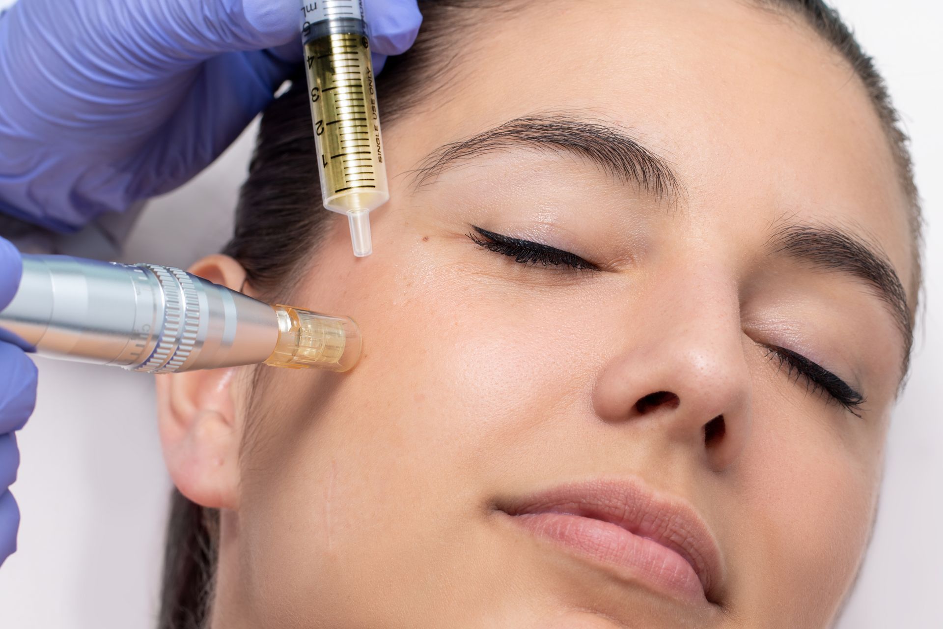 A woman is getting a microdermabrasion treatment on her face.