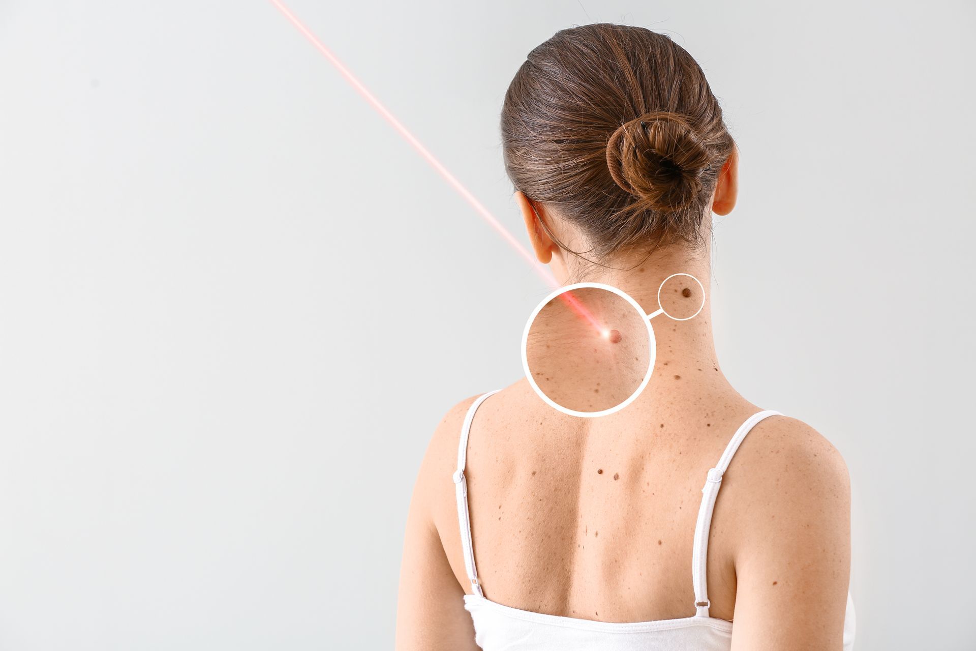 A woman is getting a laser treatment on her neck.