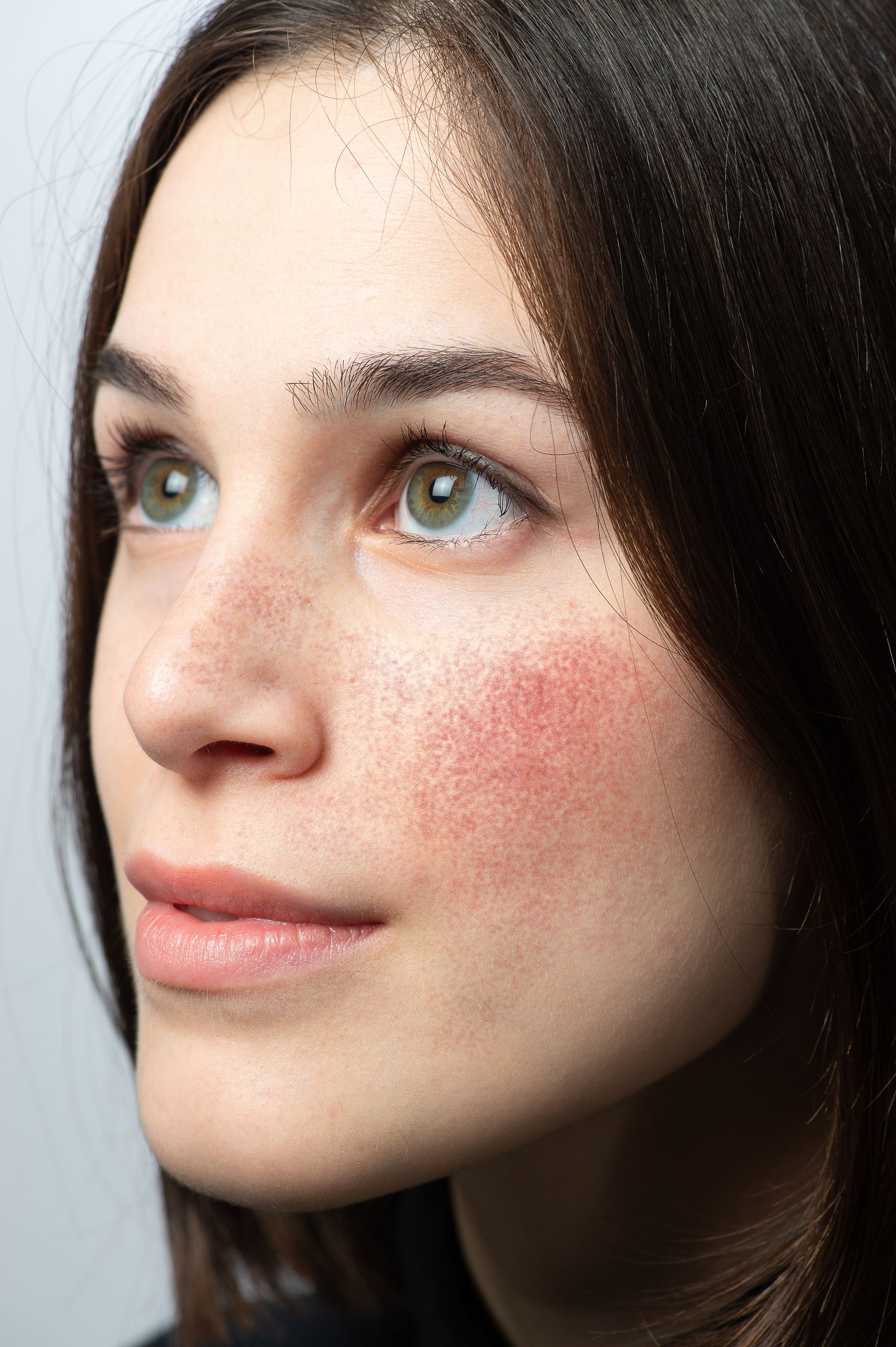 A close up of a woman 's face with freckles.