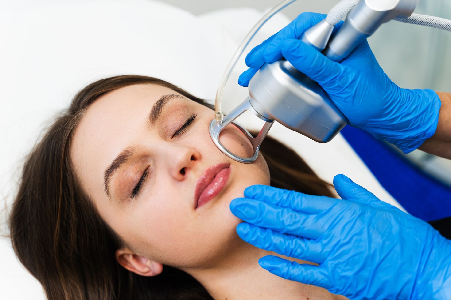 Woman receiving laser skin treatment on her face; gloved hands holding device.
