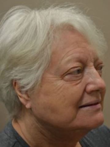 Woman with short, white hair, looking right with a slight smile.
