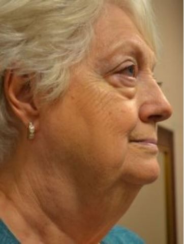 Woman with white hair, smiling gently, in profile view, wearing small hoop earrings.