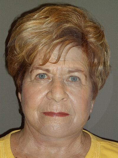 Woman with short, layered blonde hair, wearing a yellow shirt, looking directly at the viewer.