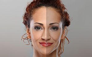 Woman's face split vertically; one side is lighter, the other darker, revealing a possible before and after comparison.