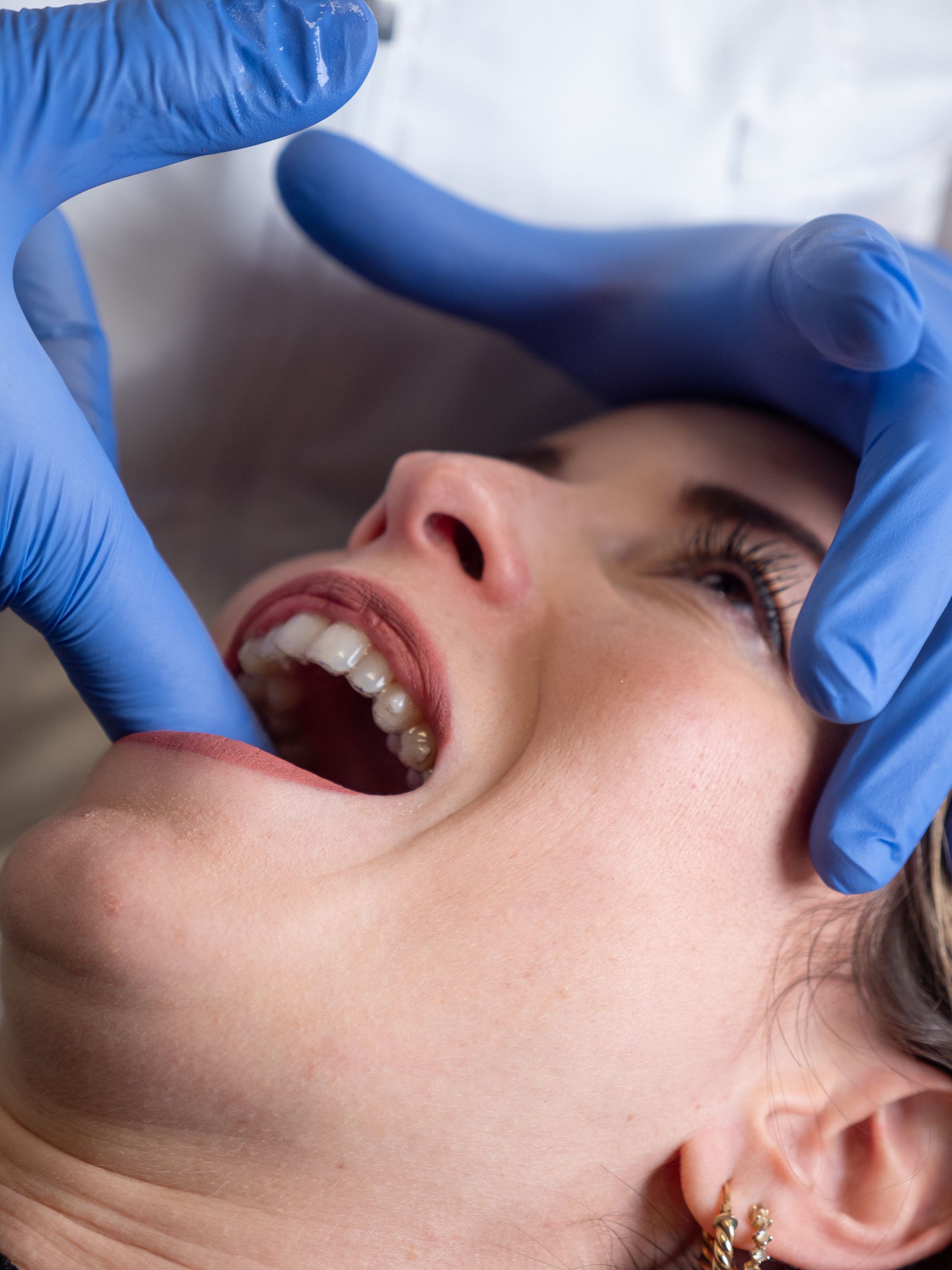 riabilitazione dell’Articolazione Temporo-Mandibolare