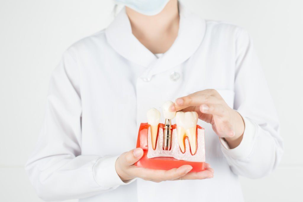 Why Dental Implants Are a Practical Investment