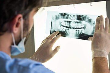 Dentist Assessing Dental X-ray - Implant Surgery in New Bedford, MA