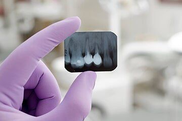 Dentist Showing Dental Film - Implant Surgery in New Bedford, MA