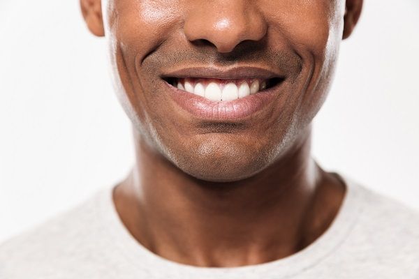 Teeth Whitening Glenview