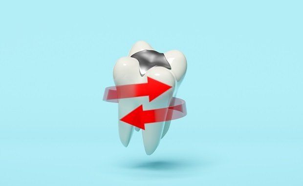 3 stages of root canal treatment