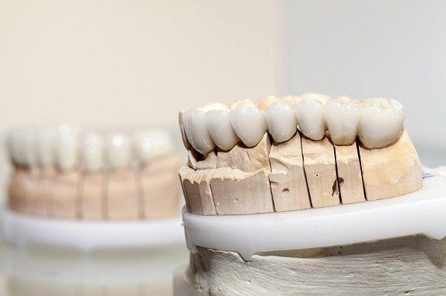 Which Veneers Are The Most Natural Looking