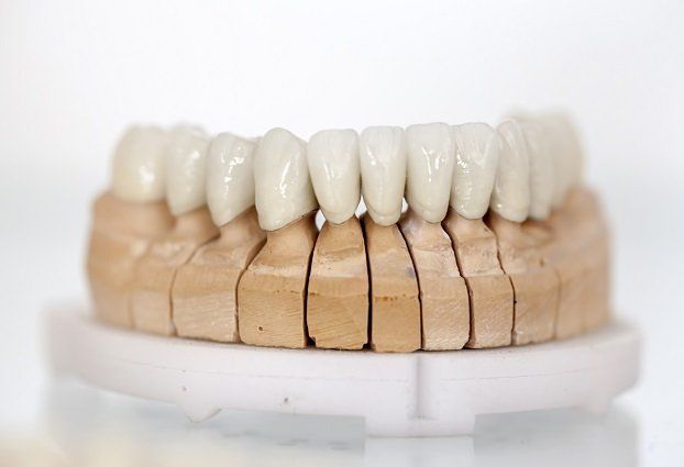 Dental Veneers Glenview