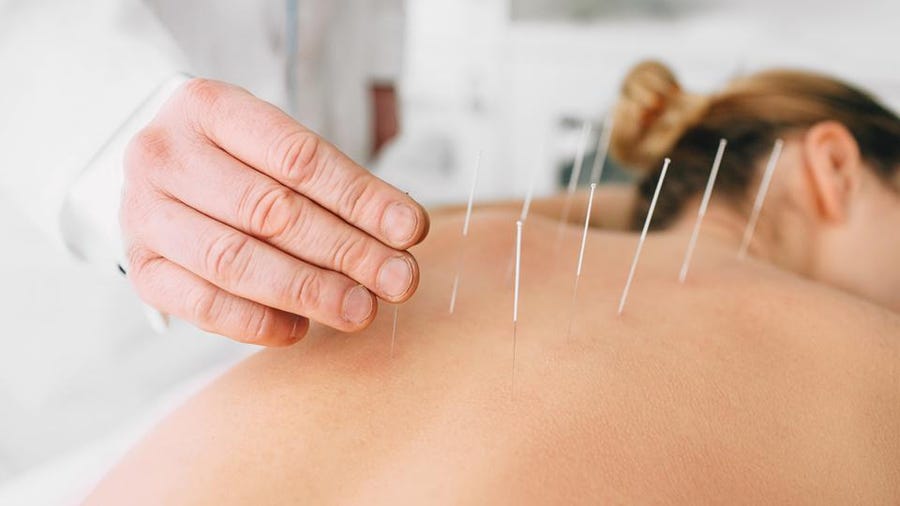 Acupuncture Leamington Spa